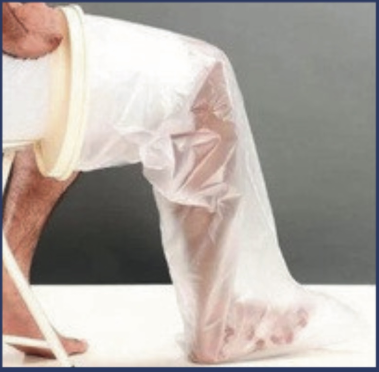 Cast Cover Leg Ankle to Thigh — Scanda Enterprises, medical supplies Moosapet Hyderabad
